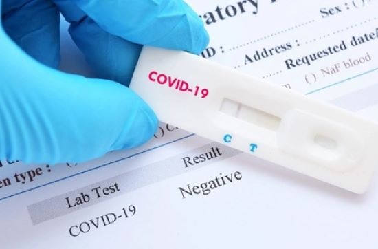 3075 са новодиагностицираните с коронавирусна инфекция 